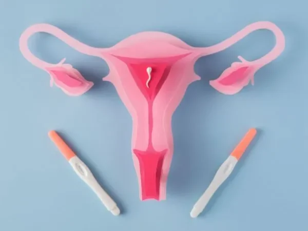 IUI for PCOS Patients in Delhi: Success Tips and Treatment Protocols