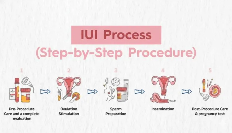 IUI process step by step