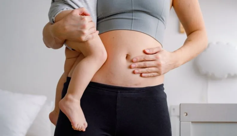 Is VBAC Safer Than Having a Second C-Section