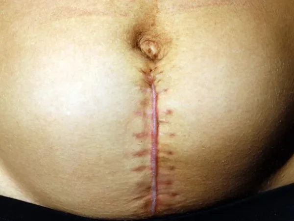 What Does Postpartum Recovery Actually Feel Like in the First 6 Weeks?