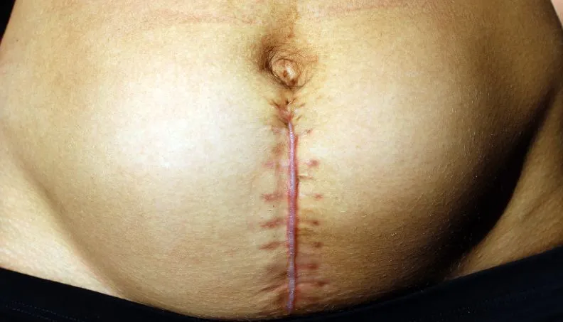 What Does Postpartum Recovery Actually Feel Like in the First 6 Weeks