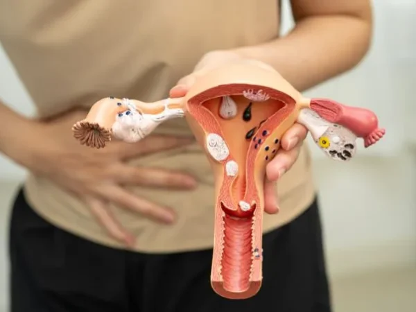 Ovarian Torsion: The Emergency That Looks Like Stomach Pain and Why Missing It Can Cost You an Ovary
